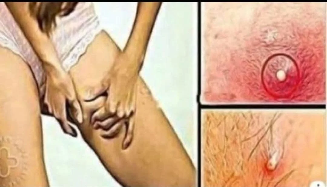 Close-up of skin showing concerning spots, highlighting potential health issues.