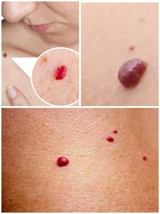 Skin with red dots indicating potential health issues or conditions.