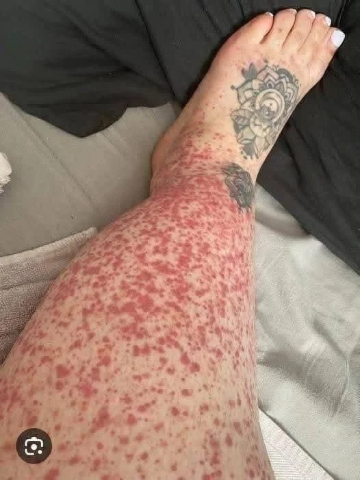 Illustration showing the consequences of sleeping on health and relationships.